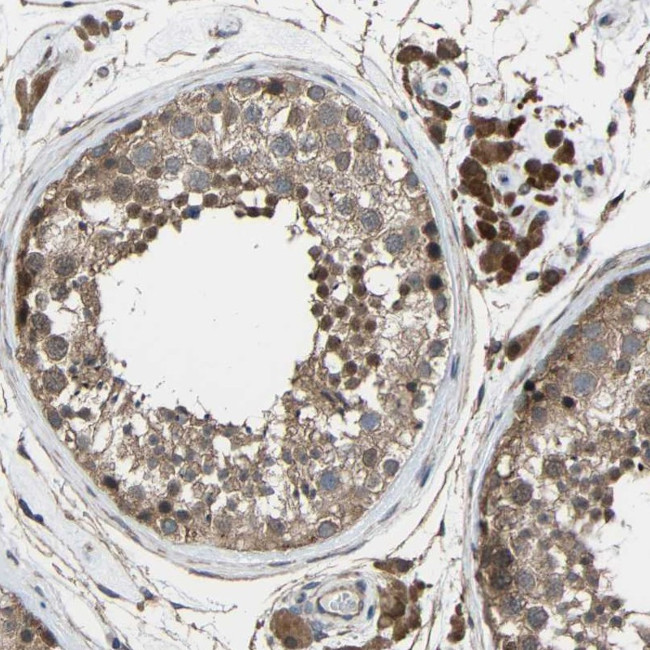 CHST9 Antibody in Immunohistochemistry (Paraffin) (IHC (P))