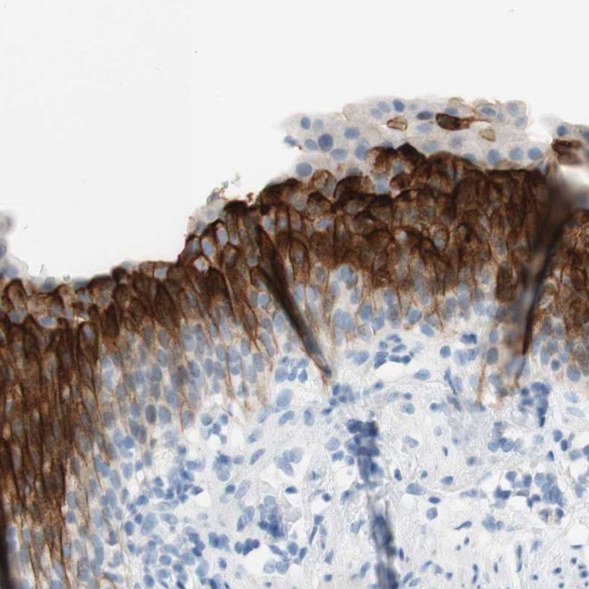 UPK3BL Antibody in Immunohistochemistry (Paraffin) (IHC (P))