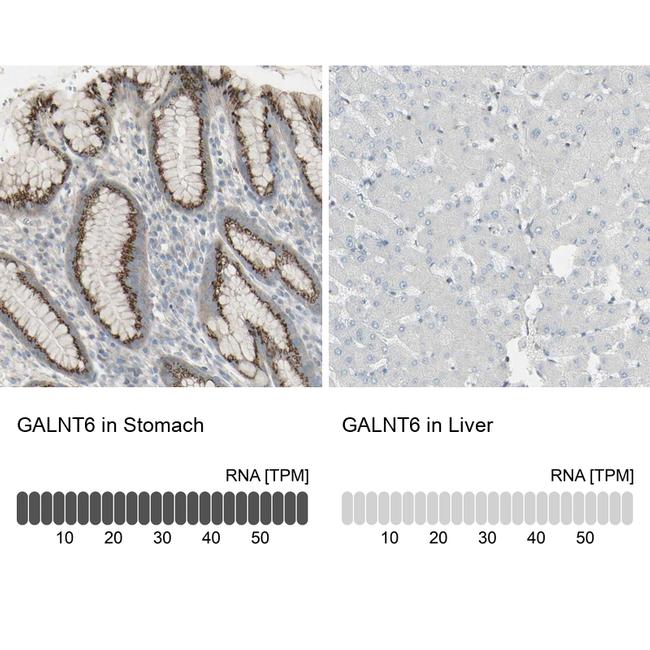 GALNT6 Antibody in Immunohistochemistry (IHC)