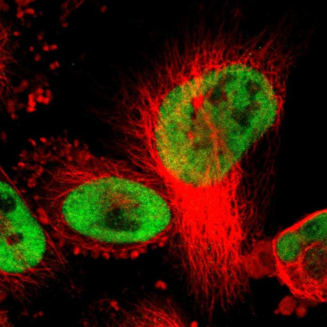 Cullin 4B Antibody in Immunocytochemistry (ICC/IF)