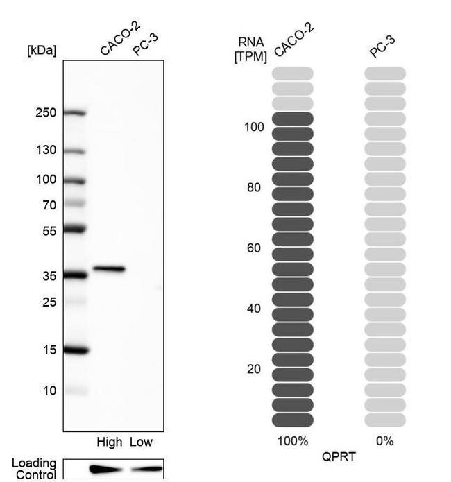 QPRT Antibody in Western Blot (WB)