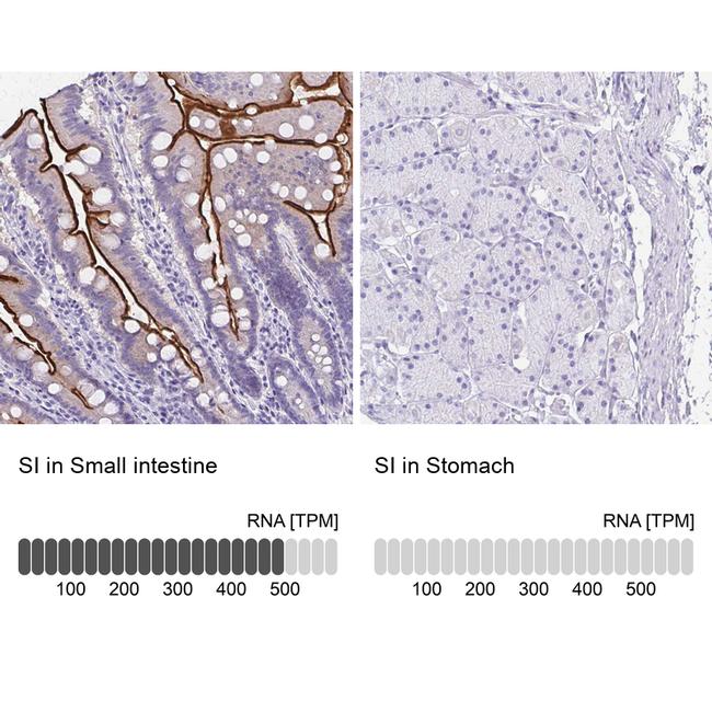 SI Antibody in Immunohistochemistry (IHC)