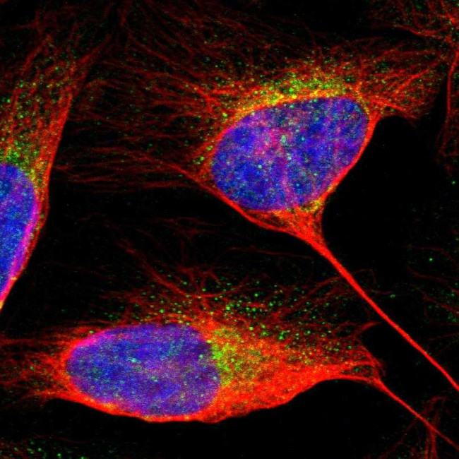 Alix Antibody in Immunocytochemistry (ICC/IF)