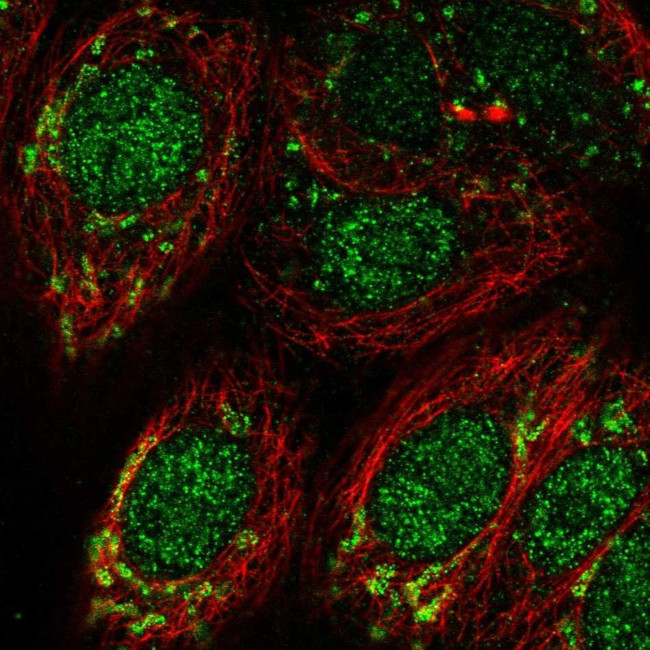 DHODH Antibody in Immunocytochemistry (ICC/IF)