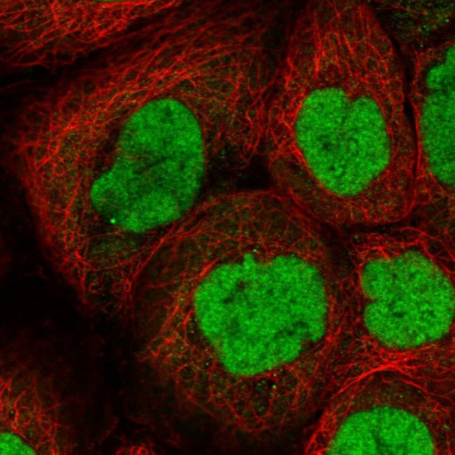 CHD4 Antibody in Immunocytochemistry (ICC/IF)