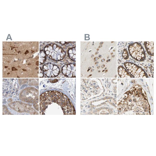 LRRC47 Antibody in Immunohistochemistry (IHC)