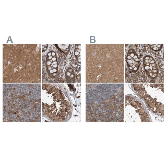 ARHGEF11 Antibody in Immunohistochemistry (IHC)