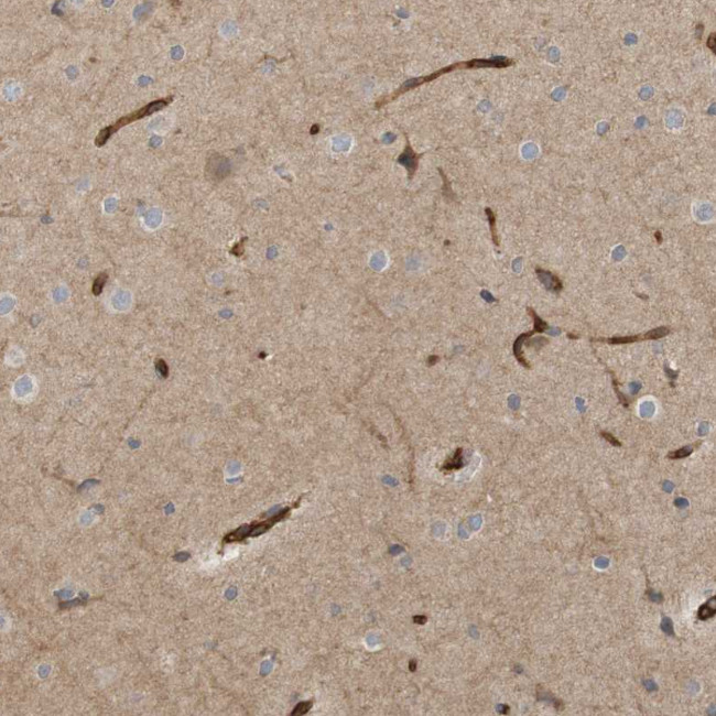 B3GAT2 Antibody in Immunohistochemistry (Paraffin) (IHC (P))