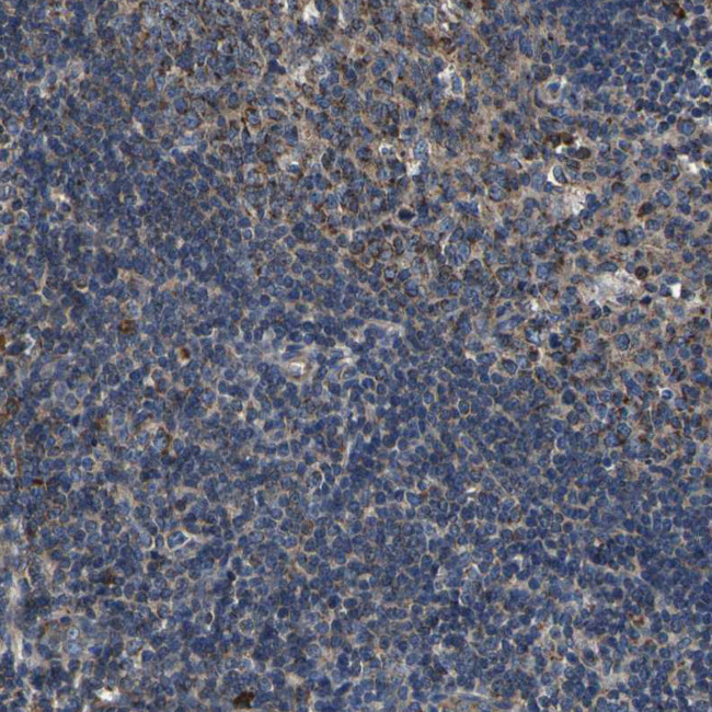 INPP5A Antibody in Immunohistochemistry (Paraffin) (IHC (P))