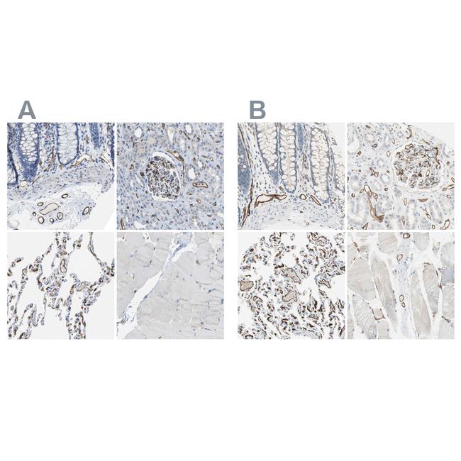 CD93 Antibody in Immunohistochemistry (IHC)