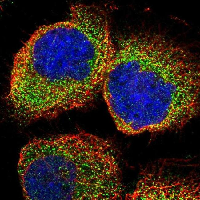 DDAH2 Antibody in Immunocytochemistry (ICC/IF)