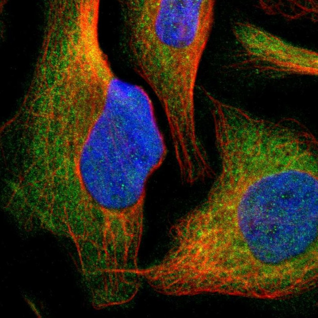 CYP26B1 Antibody in Immunocytochemistry (ICC/IF)