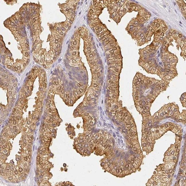 AZGP1 Antibody in Immunohistochemistry (IHC)