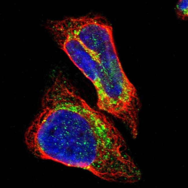 ALDH18A1 Antibody in Immunocytochemistry (ICC/IF)