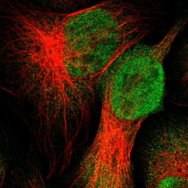 UBXN1 Antibody in Immunocytochemistry (ICC/IF)