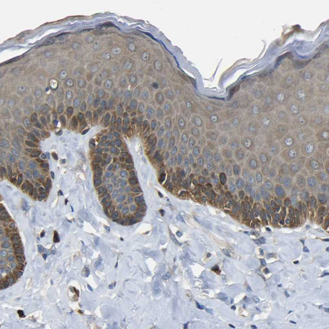 EML2 Antibody in Immunohistochemistry (Paraffin) (IHC (P))