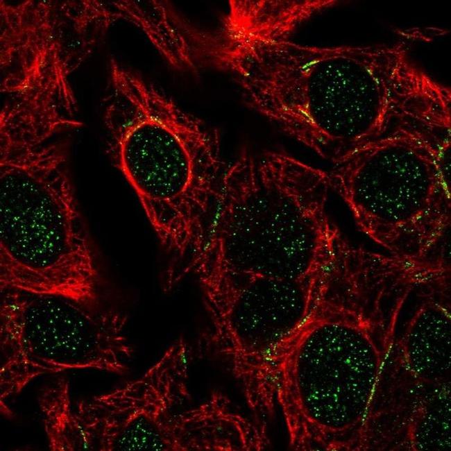 DPEP1 Antibody in Immunocytochemistry (ICC/IF)