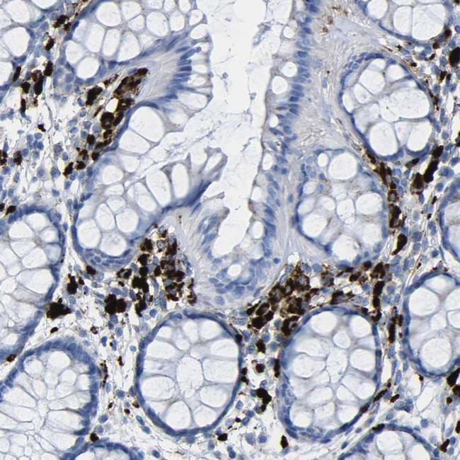 PLD3 Antibody in Immunohistochemistry (IHC)