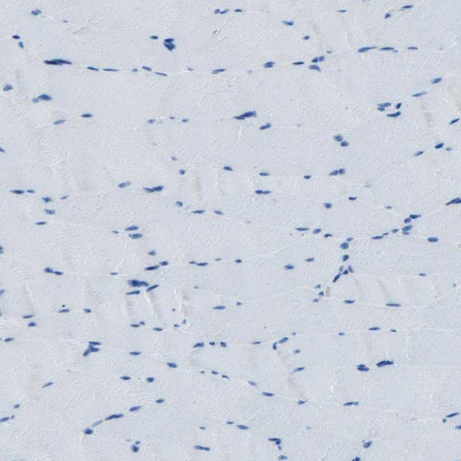 Fibrillin 2 Antibody in Immunohistochemistry (Paraffin) (IHC (P))