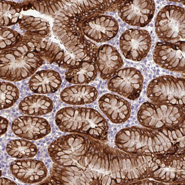 Cathepsin E Antibody in Immunohistochemistry (Paraffin) (IHC (P))