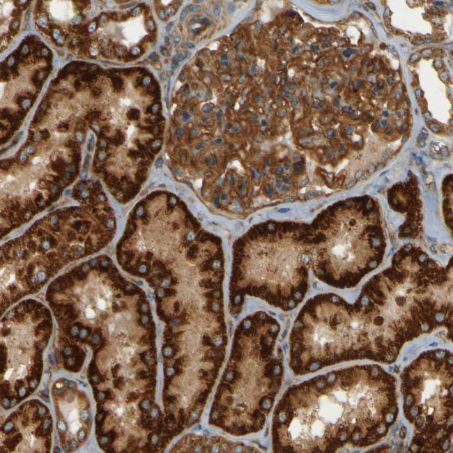 CSP alpha Antibody in Immunohistochemistry (Paraffin) (IHC (P))