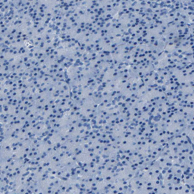 Claudin 11 Antibody in Immunohistochemistry (Paraffin) (IHC (P))