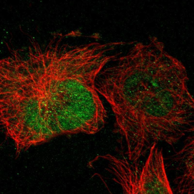 POMK Antibody in Immunocytochemistry (ICC/IF)