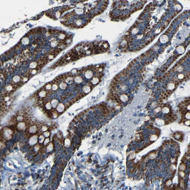 WSCD2 Antibody in Immunohistochemistry (Paraffin) (IHC (P))