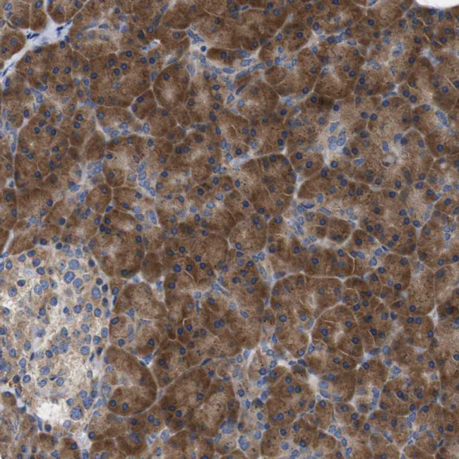 DDRGK1 Antibody in Immunohistochemistry (Paraffin) (IHC (P))