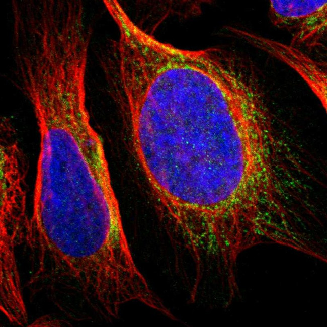 SNX19 Antibody in Immunocytochemistry (ICC/IF)