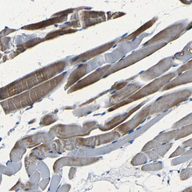 NCMAP Antibody in Immunohistochemistry (Paraffin) (IHC (P))