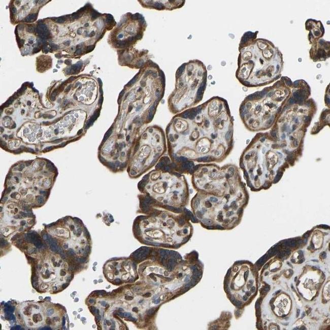 OS9 Antibody in Immunohistochemistry (IHC)