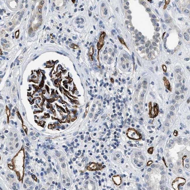 SLCO2A1 Antibody in Immunohistochemistry (IHC)