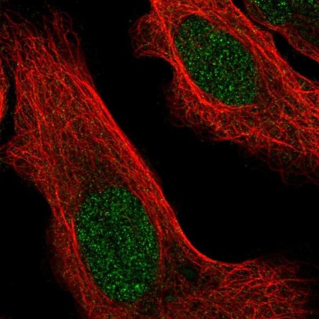 ZBTB46 Antibody in Immunocytochemistry (ICC/IF)