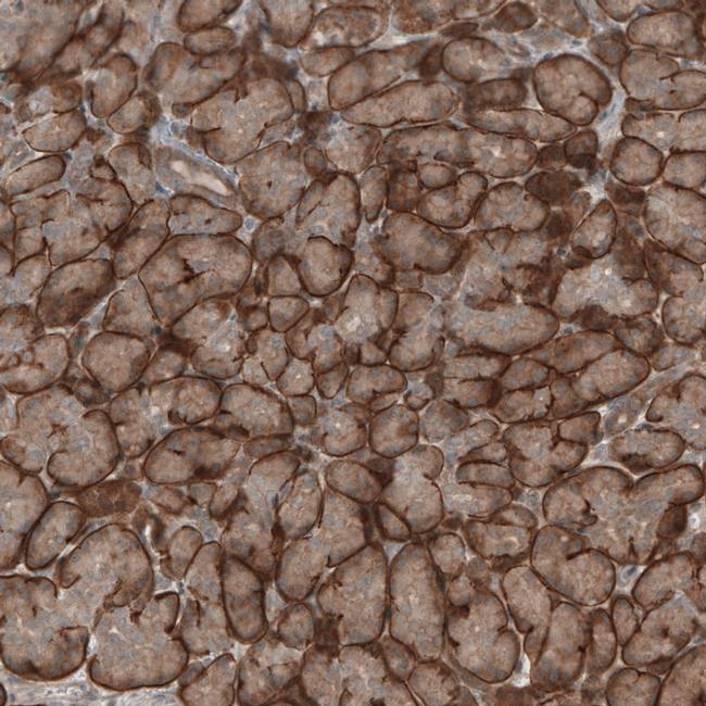 KANK4 Antibody in Immunohistochemistry (IHC)