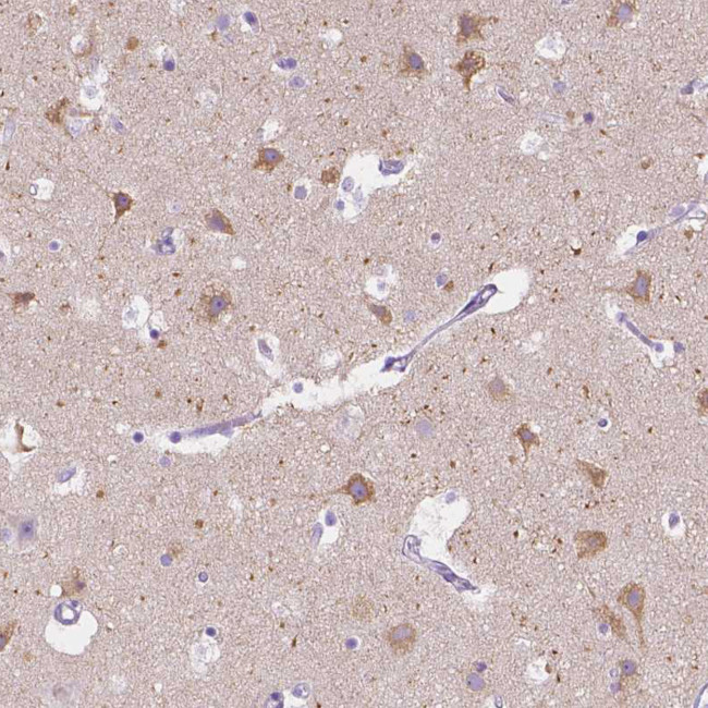 CHRM1 Antibody in Immunohistochemistry (Paraffin) (IHC (P))