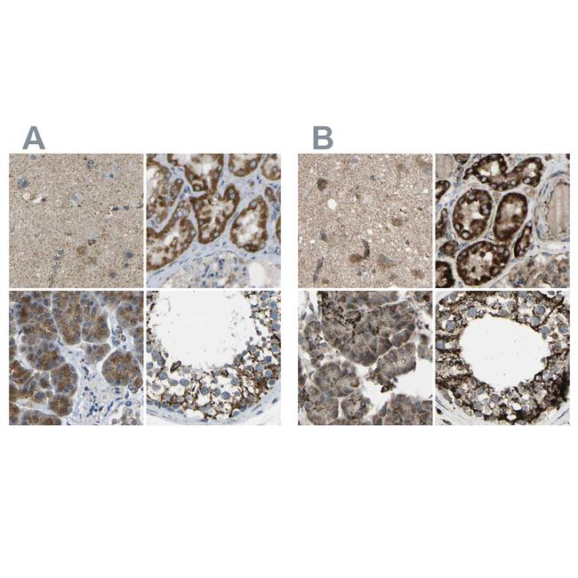 CYB5R1 Antibody in Immunohistochemistry (IHC)