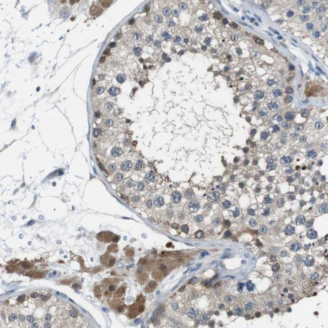 NANOS2 Antibody in Immunohistochemistry (Paraffin) (IHC (P))