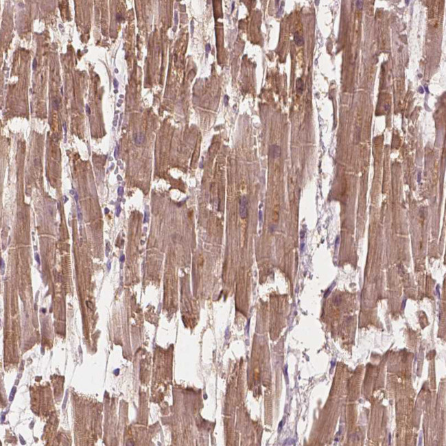 MYOM1 Antibody in Immunohistochemistry (Paraffin) (IHC (P))