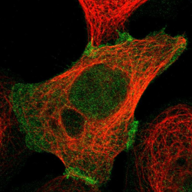 PKP2 Antibody in Immunocytochemistry (ICC/IF)