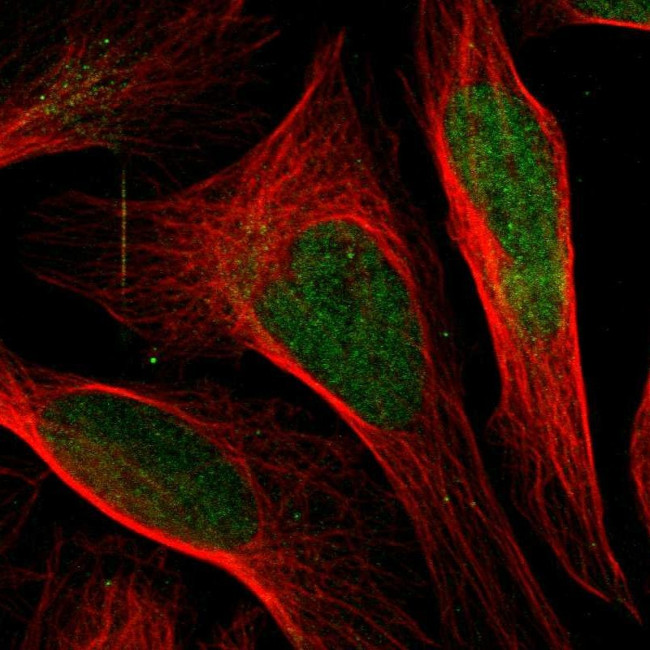 DHPS Antibody in Immunocytochemistry (ICC/IF)