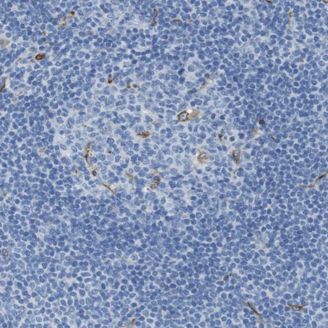 CD320 Antibody in Immunohistochemistry (Paraffin) (IHC (P))