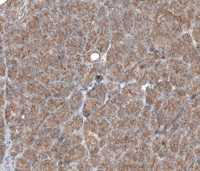 TMEM30A Antibody in Immunohistochemistry (IHC)