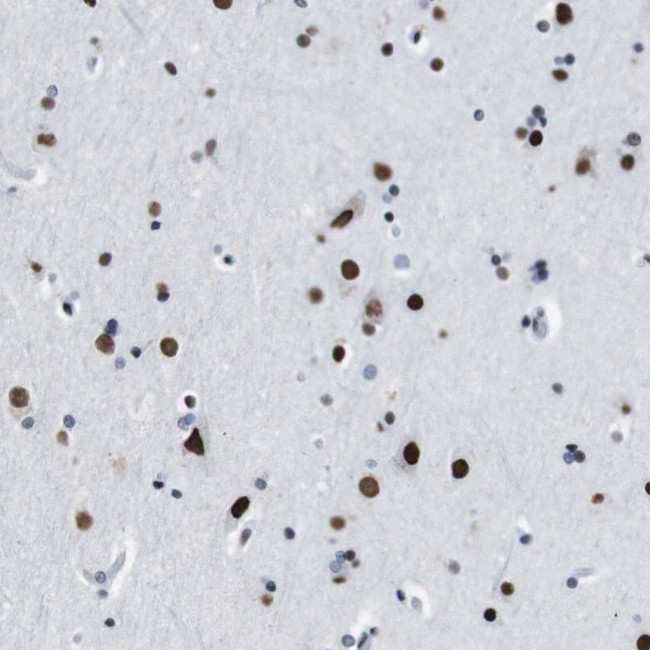 TMEM55A Antibody in Immunohistochemistry (Paraffin) (IHC (P))