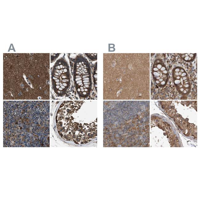 ARHGEF11 Antibody in Immunohistochemistry (IHC)