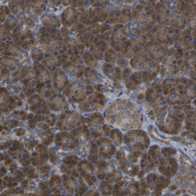 DPM3 Antibody in Immunohistochemistry (Paraffin) (IHC (P))