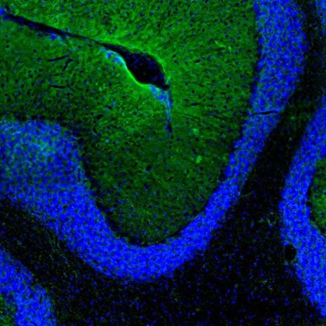 Aquaporin 4 Antibody in Immunocytochemistry (ICC/IF)