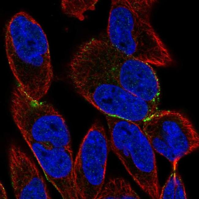 BVES Antibody in Immunocytochemistry (ICC/IF)