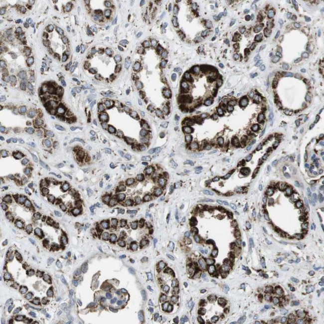 KCNE3 Antibody in Immunohistochemistry (Paraffin) (IHC (P))