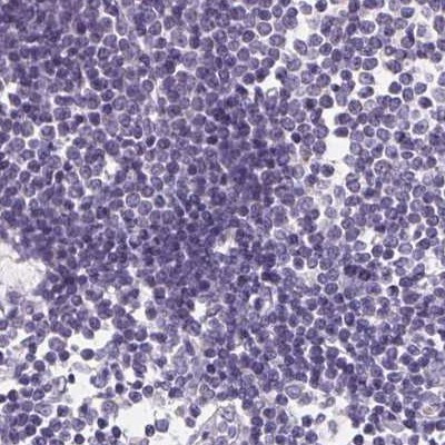 ASGR2 Antibody in Immunohistochemistry (Paraffin) (IHC (P))